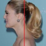 Forward Head Posture and Pain