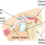 Common Rowing Mistakes